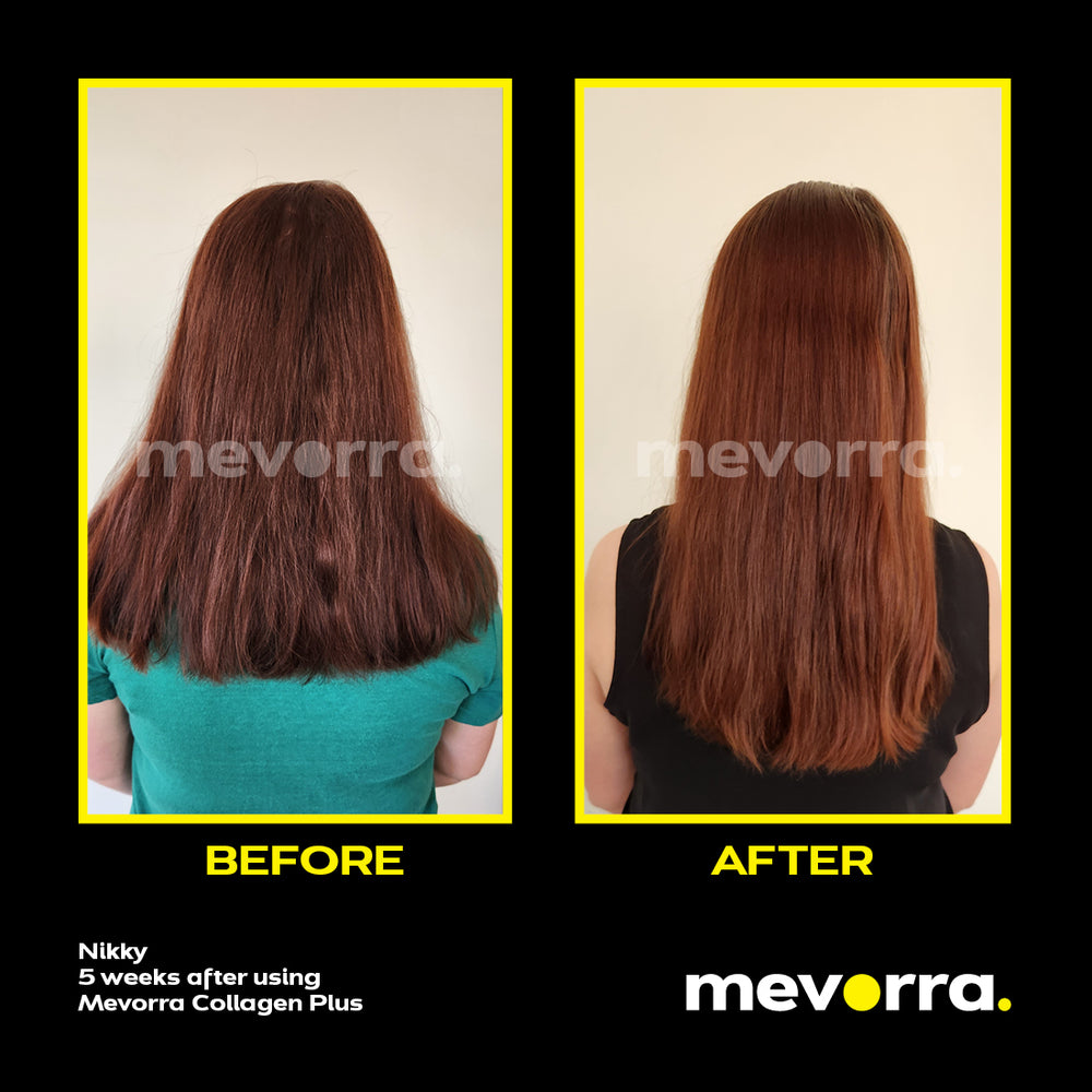 Mevorra Collagen Plus Before and After